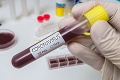Hrozivé zistenie: Koronavírus sa vrátil najmenej 74 vyliečeným ľuďom