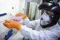Koronavírus zabil v Česku 91 ľudí: V krajine spravili za deň rekordný počet testov