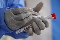 Štátni veterinári pomôžu s testovaním obyvateľov na koronavírus: Počet testov vzrastie denne o 200 až 300