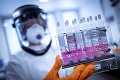 Krajiny hľadajú liek na koronavírus: Niektoré z testovaných ukazujú sľubné výsledky