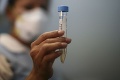 V Arménsku vyčíňala prasacia chrípka: Zomrelo 18 ľudí!
