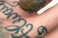 Muž si nechal laserom odstrániť tetovanie: O pár hodín mu na prste vyrašil neskutočný hnus