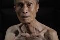 Muž prežil útok na Nagasaki, kusy kože z neho viseli ako handry: Pohľad na to zničené telo bude bolieť aj vás