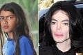 Syn Michaela Jacksona sa hanbí za meno, ktoré mu dal slávny otec: Stal sa terčom posmechu!