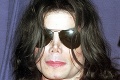 Tajomstvá Michaela Jacksona odhalené: Prečo si bielil kožu? Ten dôvod vháňa slzy do očí!