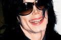 Jacksonov syn Prince Michael: Záhadné škvrny na koži!
