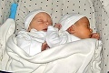 Manželom sa narodili dvojičky, no až po šiestich týždňoch zbadali ten výrazný rozdiel: Ako je toto možné?