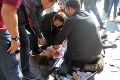 Krvavý útok na pochod mieru v Turecku: Hrôzostrašné svedectvá ľudí, ktorí boli na mieste
