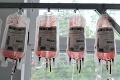 NÚSCH hlási nedostatok krvi: Darcovia môžu hromadne pomôcť