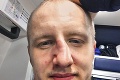 Radovan Puliš odohral na turnaji iba pár minút: Takto mi napravili nos!