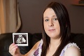 Šla ku gynekológovi a nastal šok: Na ultrazvuku videla tvár svojej babky!