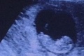 Fotka z ultrazvuku ovládla internet, ľudia sú zdesení: Vidíte to tam aj vy?!