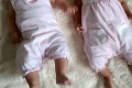 Až dva týždne po pôrode dvojičiek si všimla ten rozdiel: Šanca, že sa narodia takéto deti, je jedna k miliónu!