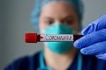 Na Nový Zéland sa dostal koronavírus skôr, než si mysleli: Prvý prípad bol z Európy