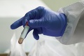 Belgicko má už vyše 1000 úmrtí na koronavírus: Sila epidémie postupe slabne