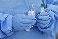 Koronavírus v USA: Vymykajú sa priemerom, nemocnice obsadzujú mladí ľudia