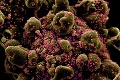 Katastrofický scenár pre USA: Koronavírus najbližšie mesiace zabije vyše 80 000 ľudí