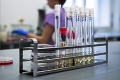 V Brne hospitalizovali muža s podozrením na koronavírus: Expresné výsledky testov