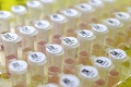 Zbaví nás nákazy? Talianski vedci začnú s testovaním vakcíny proti COVID-19