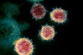 Smrtiaci koronavírus vo svete: V Iraku vyhlásili celoštátnu karanténu, Kolumbia hlási prvé úmrtie