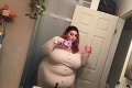 Mega obézna žena skonzumuje denne tisícky kalórií, z jej tela vás strasie: Chorý dôvod, pre ktorý sa prežiera