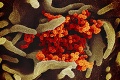 Rozšíril sa do ďalšej krajiny: Irán potvrdil prvé dva prípady nákazy koronavírusom