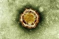 Jeho šírenie nebude jednoduché zastaviť: Koronavírus sa prenáša už počas inkubačnej doby