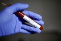 Ďalší pozitívny test: Francúzsko potvrdilo 5. prípad nákazy koronavírusom