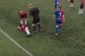 Zábery, z ktorých behá mráz po chrbte: Futbalistke vyskočilo koleno, takto s ním bojovala