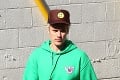 Bieber priznal hrozivú príčinu, prečo vyzerá tak zle: Ľudia si mysleli, že je na drogách
