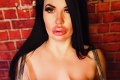 Modelka si dala urobiť prsia GIGArozmerov: Masaker, čo jej vylieza z podprsenky