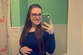 Mladý pár sa snažil o bábätko 2 roky: Keď sestrička zbadala na ultrazvuku výsledok, musela si sadnúť
