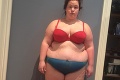 Lekár ju schladil, že je príliš tučná na počatie dieťaťa: Zo 144 kg kôpky nešťastia je sexi kosť