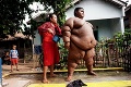 Kedysi vážil 191 kíl a bol najtučnejším chlapcom na svete: Šokujúce fotky po premene