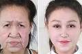 Mladučké dievča malo tvár 60-ročnej stareny: Odpadnete, ako vyzerá teraz