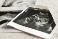 Slováci vyjadrili svoj názor na sprísnenie potratov: Výsledky prieskumu hovoria za všetko
