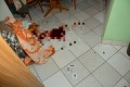 Vražda v Považskej Bystrici: Muž zomrel po bodnutiach kuchynským nožom