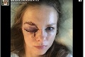Desivé zranenie redaktorky RTVS na hokejovom zápase: Hrozivý pohľad na jej tvár