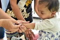 Rodičia detí, pripravte sa na zmeny: Očkovanie proti osýpkam, mumpsu a ružienke bude oveľa skôr