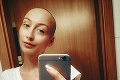 Katka († 33) zomrela na rakovinu: Pred mesiacom prišla s úžasnou správou, takýto zvrat nečakal nikto