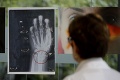 Nemocnica sa rozhodla ukázať röntgenové snímky zbitých žien: Foto č. 3 vami otrasie!