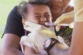 Na Samoe zabíja epidémia osýpok malé deti: Denne pribúdajú stovky prípadov
