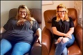 Žena bojovala roky s nadváhou, pomohla až operácia: Po roku sa zmenila na nepoznanie