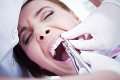 Zubár neveril, čo uvidel na röntgenovej snímke: Pacientovi vytiahol z úst svetový unikát