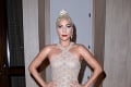 Šokujúci zvrat vo vzťahu slávnej speváčky a herečky: Lady Gaga zrušila zásnuby
