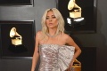 Dráma v Las Vegas: Lady Gaga sa zrútila z pódia! Jej reakcia po tvrdom páde nemá chybu