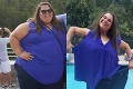 Žena mala problém zmestiť sa do auta: Po tom, čo schudla 110 kilogramov, je z nej iný človek