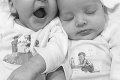 Z bábätiek vyrástli nádherné dievčatá: Pozrite si fotky najkrajších dvojičiek na svete