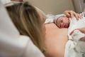 Husté slová Slovenky, ktorá pracuje v pôrodnici: To, čo adresovala čerstvým matkám, nemôžu ženy rozdýchať