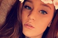Krásna tínedžerka zomrela príšernou smrťou: Päť krvilačných psov na nej úplne roztrhalo šaty
